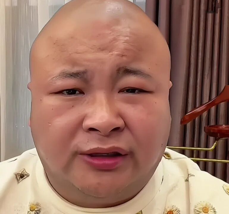 巴扎黑手部緊纏紗布太驚人!驢家23號舞台重啟 驢姐親辟方丈劉一手衝突謠言
